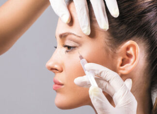¿Te aplicaste Botox? Como afecta hacer ejercicio ¿Te aplicaste Botox? Como afecta hacer ejercicio