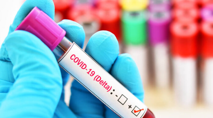 Delta: ¿Por qué esta variante del COVID es más contagiosa? Delta: ¿Por qué esta variante del COVID es más contagiosa?